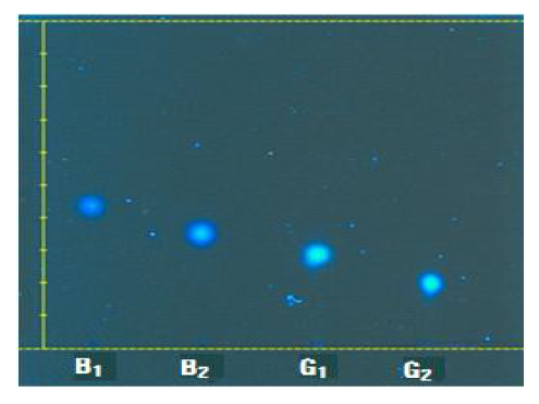 Thin layer chromathography identifying aflatoxin B1, B2, G1, G2 with Chloroform: Acetone (90:10, v/v) of mobile phase