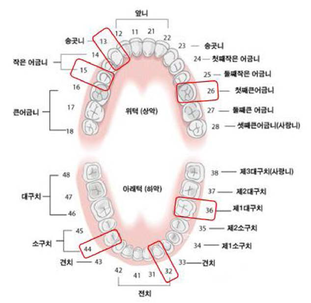 치면 세균막 측정 대상치아