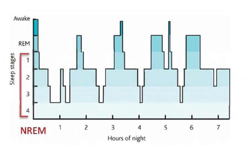 일반적인 수면의 구조(hypnogram)