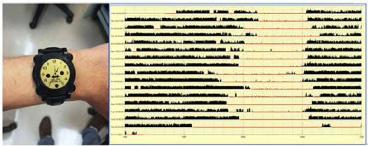 수면각성활동량 검사(sleep actigraphy)와 결과지