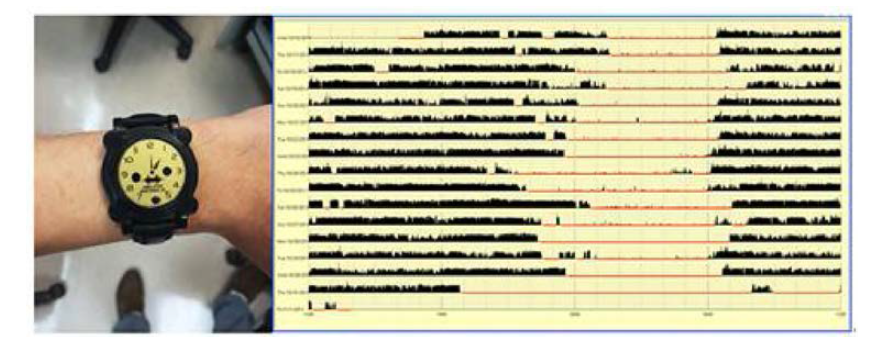 수면각성활동량 검사(sleep actigraphy )와 결과지