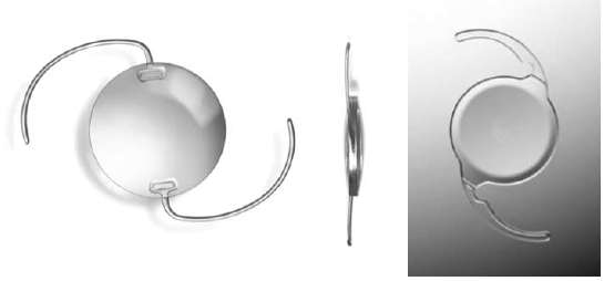 인공수정체(intraocular lens)