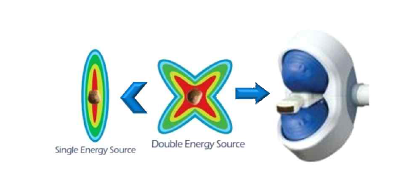듀얼 체외충격파쇄석기 예시