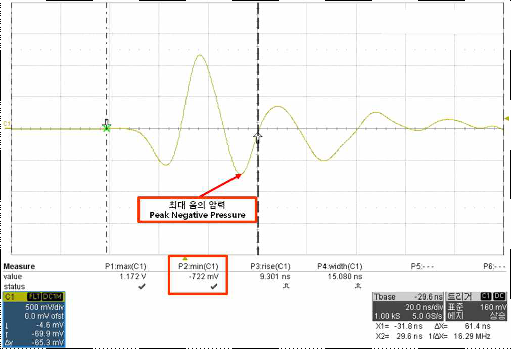 오실로스코프에서 측정한 최대 음의 압력