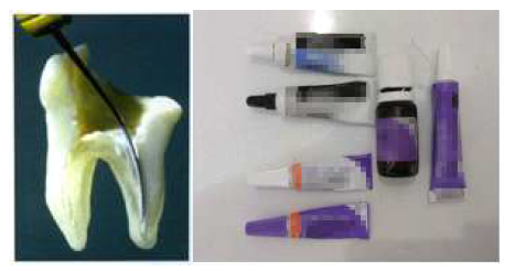 치과용근관충전실러의 적용방법(좌)과 시판제품 예(우)