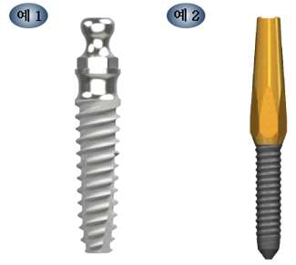 임시치과용임플란트 외관 사진 예시