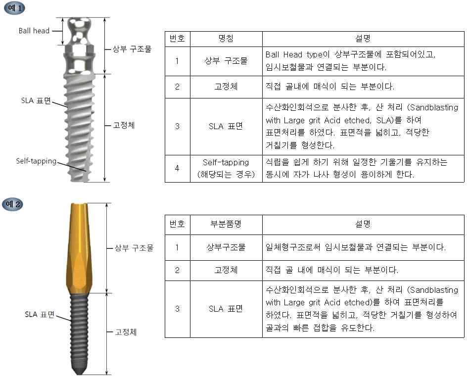 임시치과용임플란트 외관 설명 예시