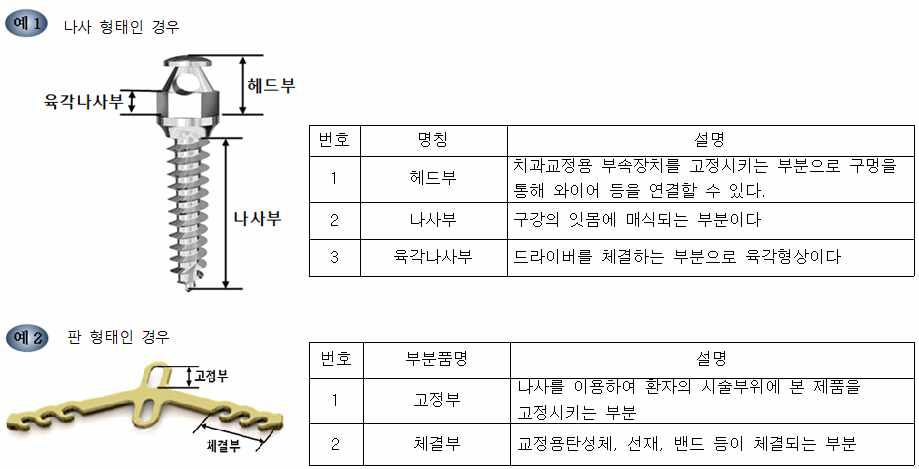 치과교정용고정장치 외관 설명 예시