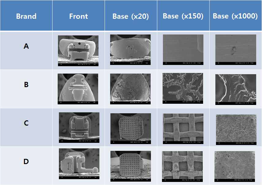 주사 전자 현미경을 이용한 맞춤형 브라켓의 베이스의 형태적 특성비교