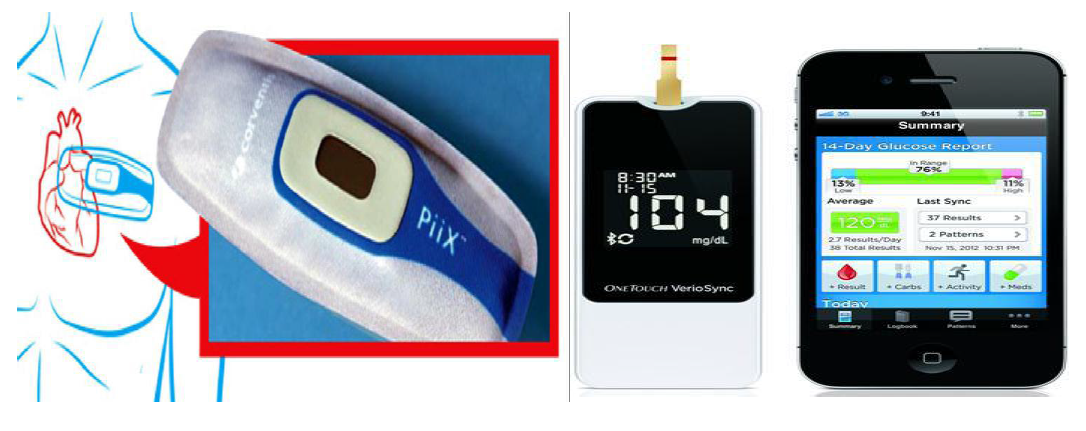 LifeScan의 혈당측정기(VerioSync)와 Corventis의 심전도측정기(PiiX)