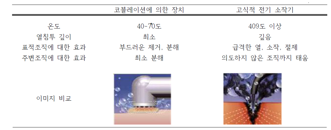 코블레이션에 의한 장치와 기존 고식적 전기소작기의 비교