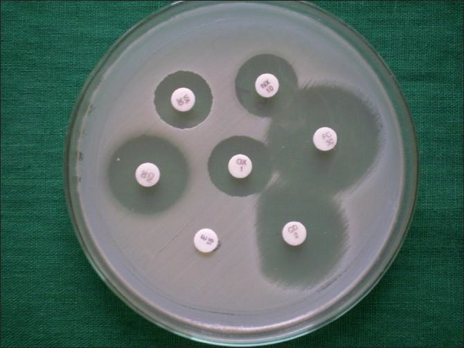 Staphyloccus 균을 대상으로 시행하는 disk diffusion 검사법 예