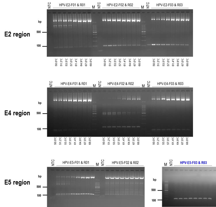 HPV18의 E2, E4, E5 유전자 검출을 위한 최적의 프라이머 선정