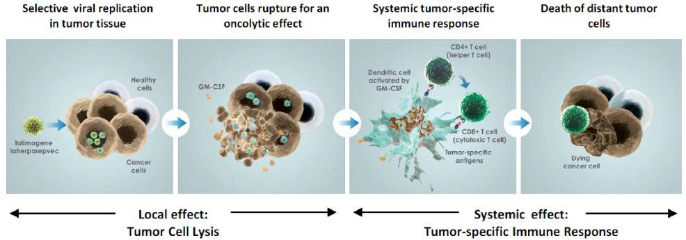 Proposed mechanism of action for Talimogene Laherparepvec