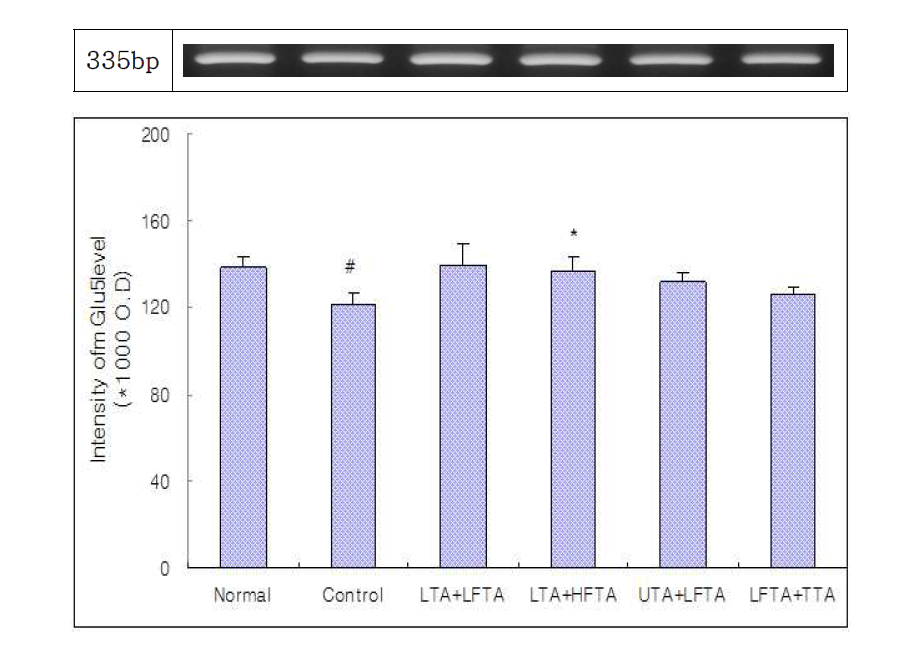 Effect of simultaneous stimulation on the mGluR5 level in pain model rat induced tibial and sural nerve transection.