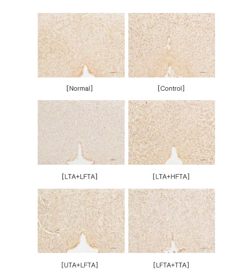 Effect of simultaneous stimulation on the c-fos activity at all groups in pain model rat induced tibial and sural nerve transection.