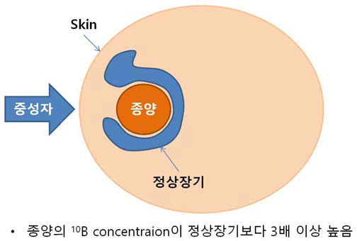 The concentration of boron in the tumor and normal organ should be at least three times greater.