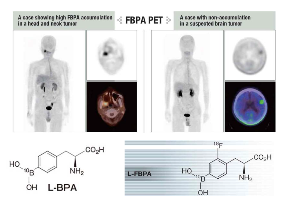 Patient selection by FBPA-PET