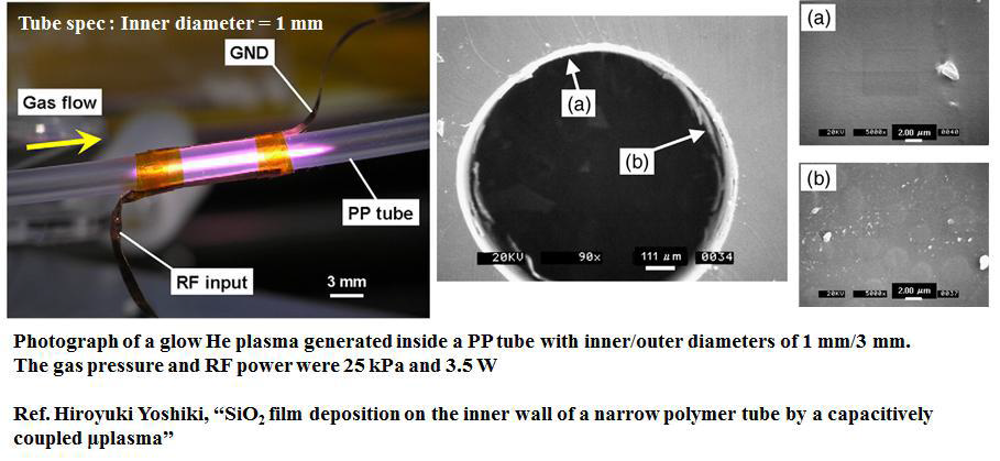 플라즈마를 이용한 소구경 고분자 튜브 내경 표면처리 기술