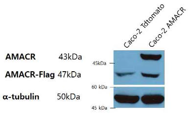 Western blotting으로 AMACR의 발현 확인