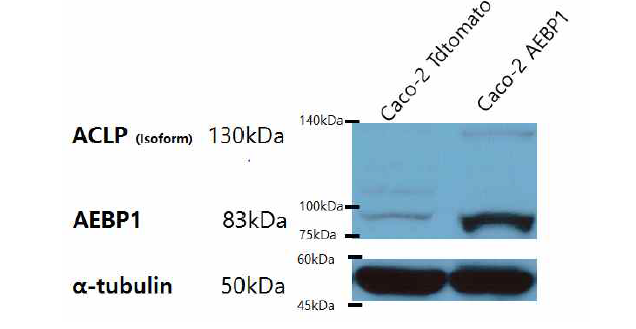 Western blotting으로 AEBP1의 발현 확인