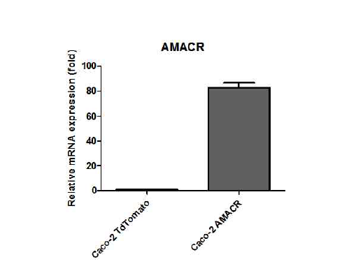 qRT-PCR로 AMACR의 발현 확인