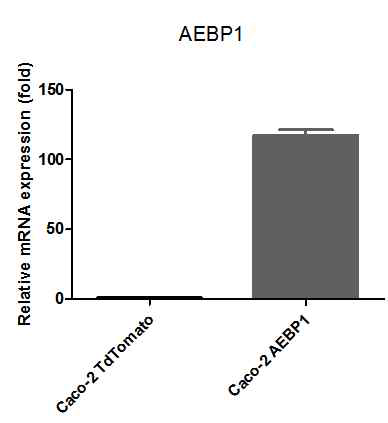 qRT-PCR로 AEBP1의 발현 확인