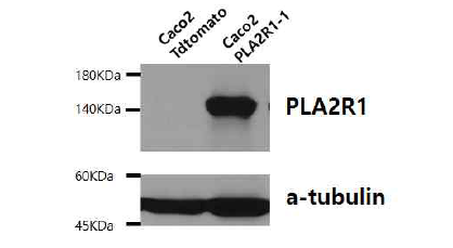 Western blotting으로 PLA2R1 발현 확인