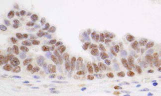 MDM4 staining in urinary bladder