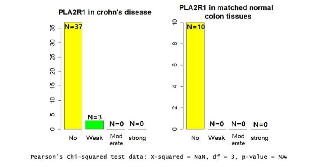 크론병 병변의 장 점막세포와 대조군인 정상 장 점막세포에서의 PLA2R1의 발현