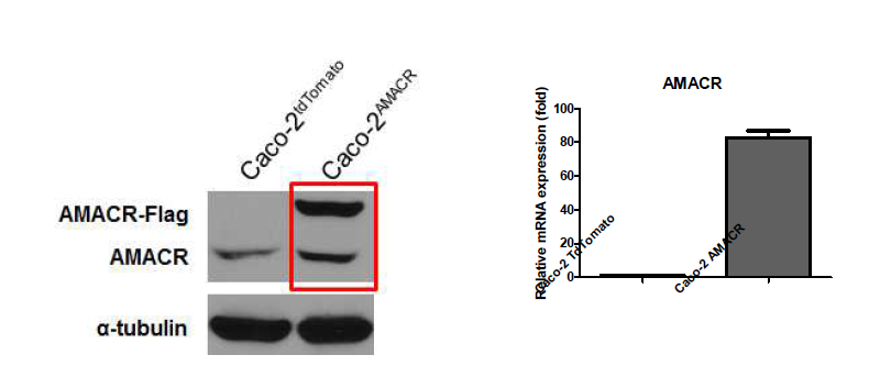 Western blottingd으로 AMACR 단백질 발현 확인