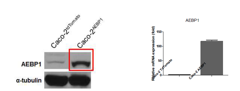 Western blottingd으로 AEBP1 단백질 발현 확인