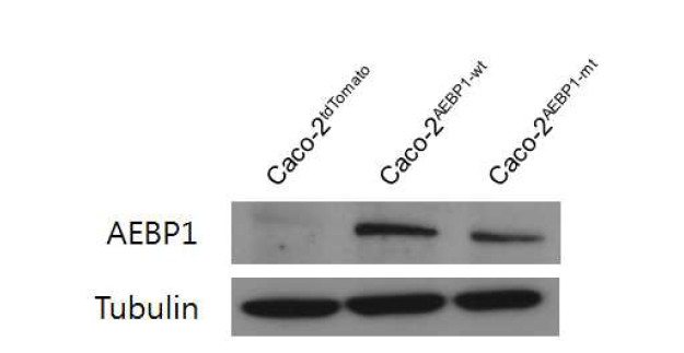 Western blottingd으로 AEBP1 wild type 및 mutant type 단백질 발현 확인