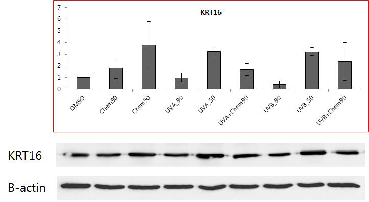 UVB 조사 시 MBEH에서 KRT16 mRNA 증가와 유사한 단백발현의 증가