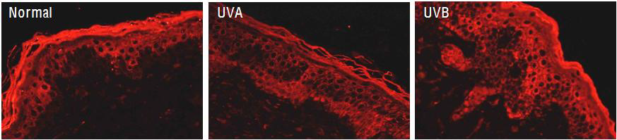 광독성 피부조직에서 AQP3 발현변화 면역형광염색