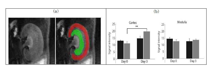 신장의 medulla (녹색)와 cortex (빨간색)의　ROI의 예. Fig. 2b. 신장의 medulla와 cortex의 signal intensities의 bar 그래프