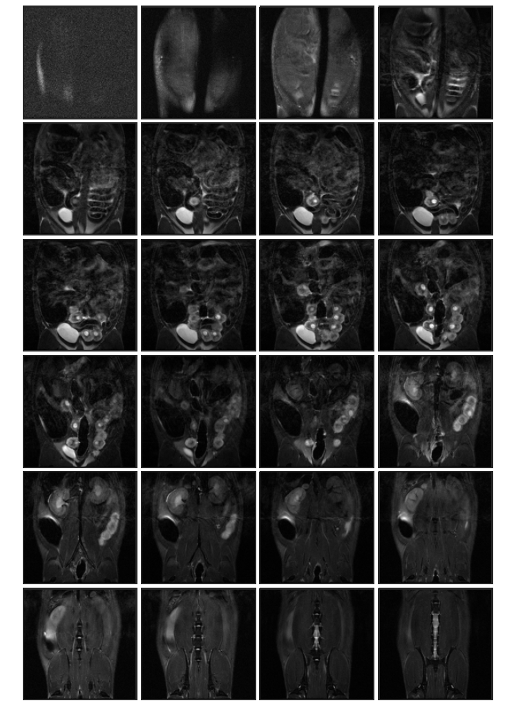 Normal control (rat 1, in-vivo) 태자의 10일 째 T2 weighted images