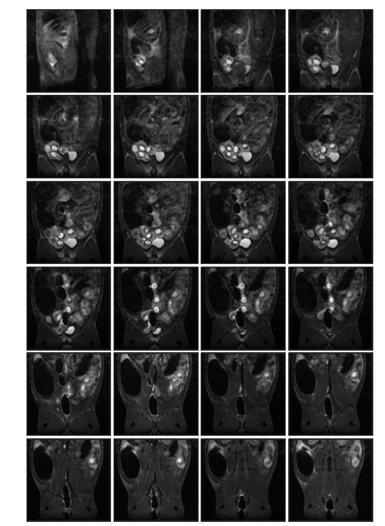 Normal control (rat 3, in-vivo) 태자의 10일 째 T2 weighted images
