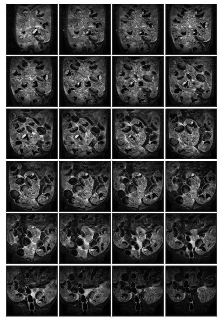 Normal control (rat 3, in-vivo) 태자의 20일 째 T2 weighted images