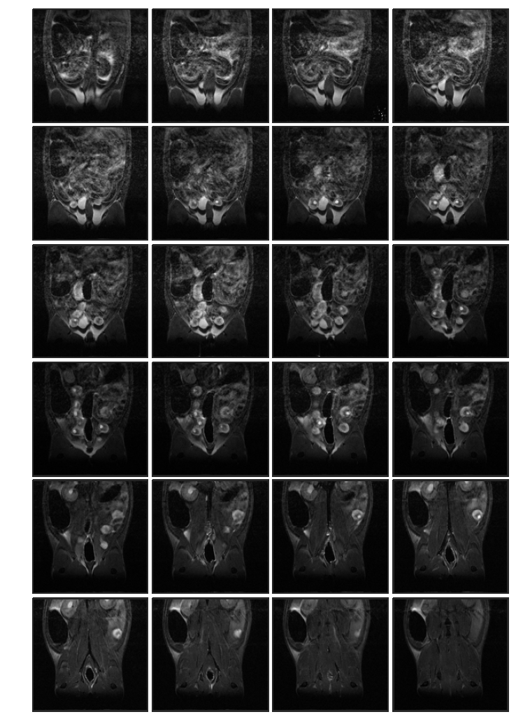 Cyclophosphamide 투여 (rat 1, in-vivo) 태자의 10일 째 T2 weighted images