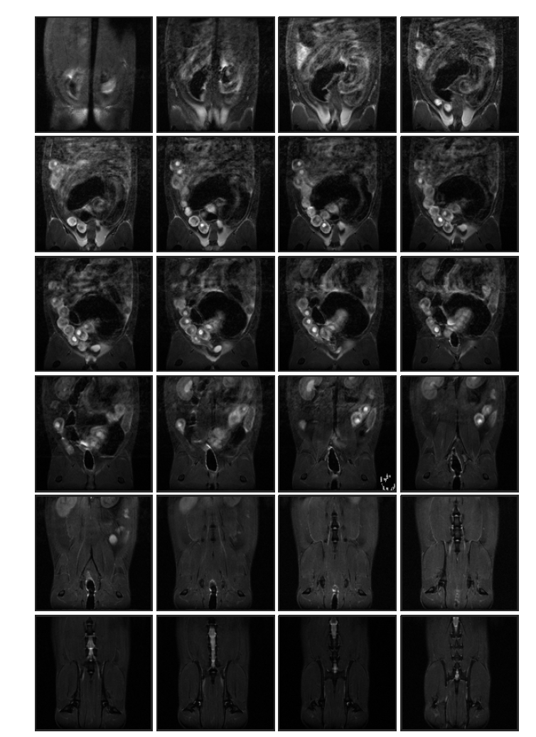 Cyclophosphamide 투여 (rat 2, in-vivo) 태자의 10일 째 T2 weighted images
