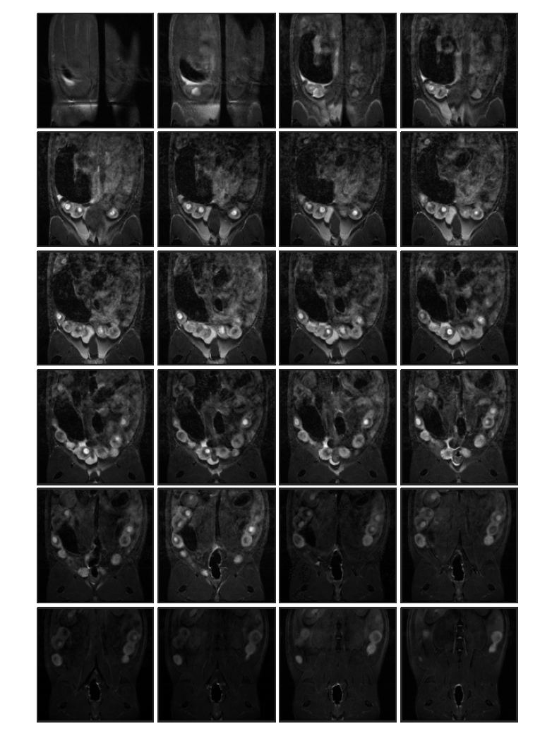 Cyclophosphamide 투여 (rat 3, in-vivo) 태자의 10일 째 T2 weighted images