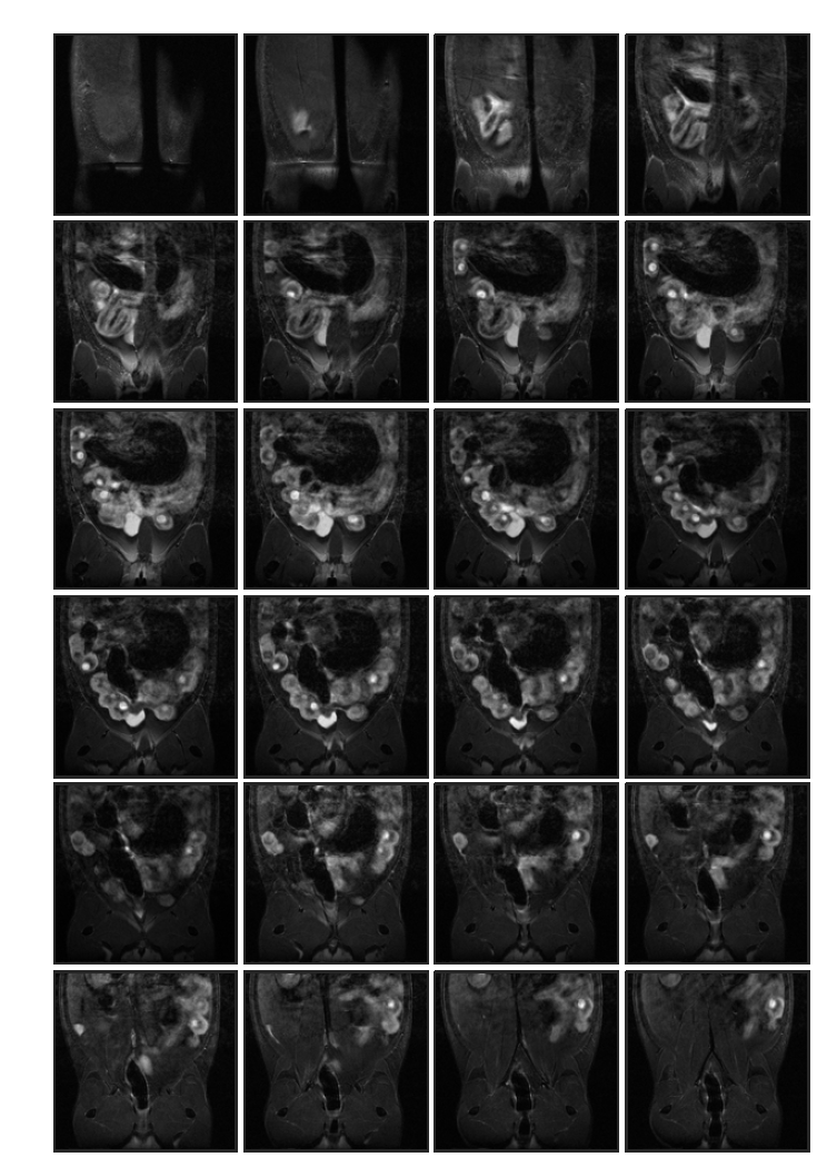 Cyclophosphamide 투여 (rat 4, in-vivo) 태자의 10일 째 T2 weighted images