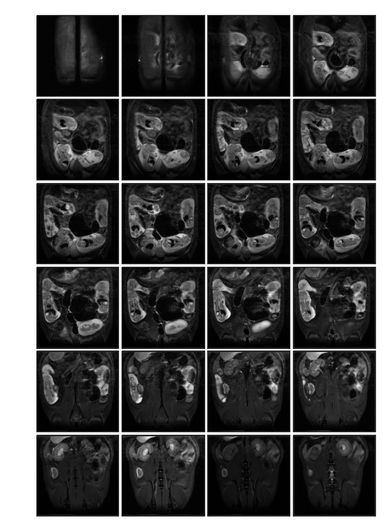 Cyclophosphamide 투여 (rat 1, in-vivo) 태자의 20일 째 T2 weighted images
