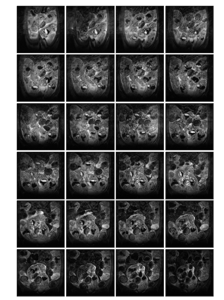 Cyclophosphamide 투여 (rat 3, in-vivo) 태자의 20일 째 T2 weighted images