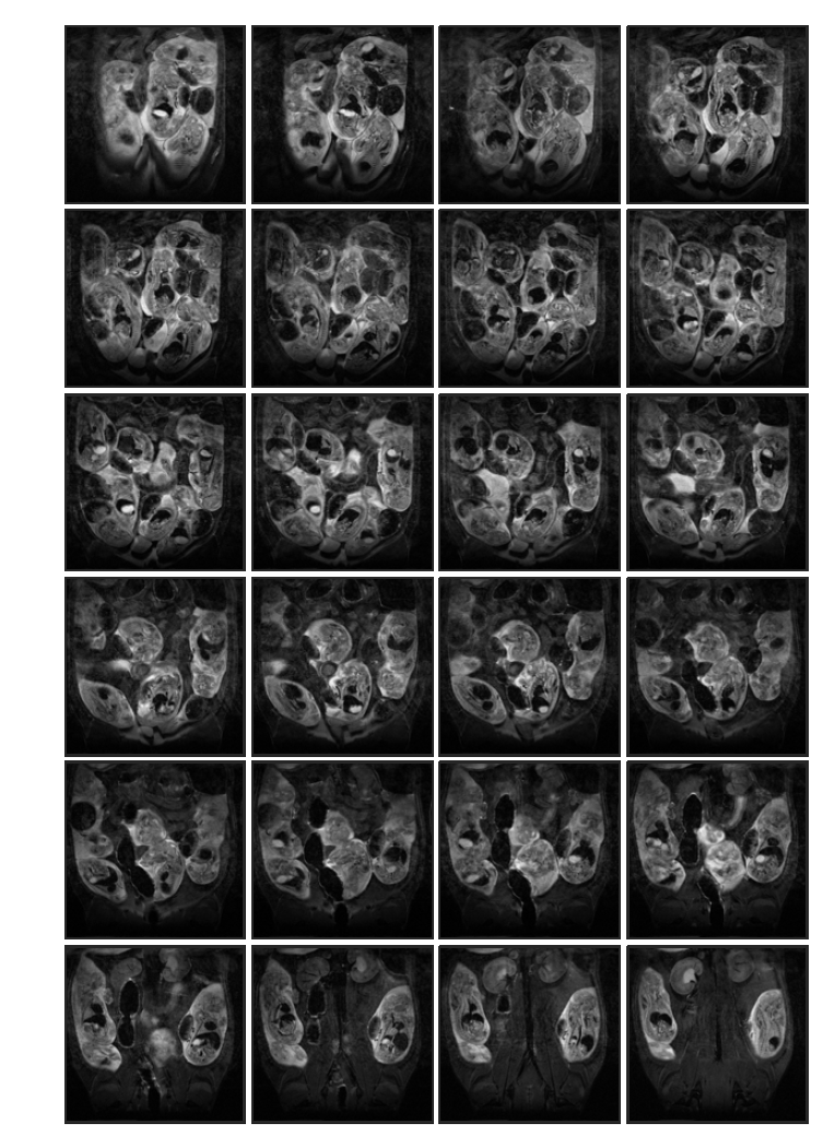 Cyclophosphamide 투여 (rat 4, in-vivo) 태자의 20일 째 T2 weighted images