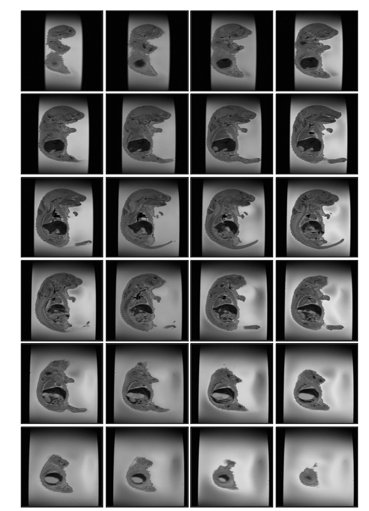 Cyclophosphamide 투여 (rat 2, ex-vivo) 후 태자의 20일 째 T2 weighted images