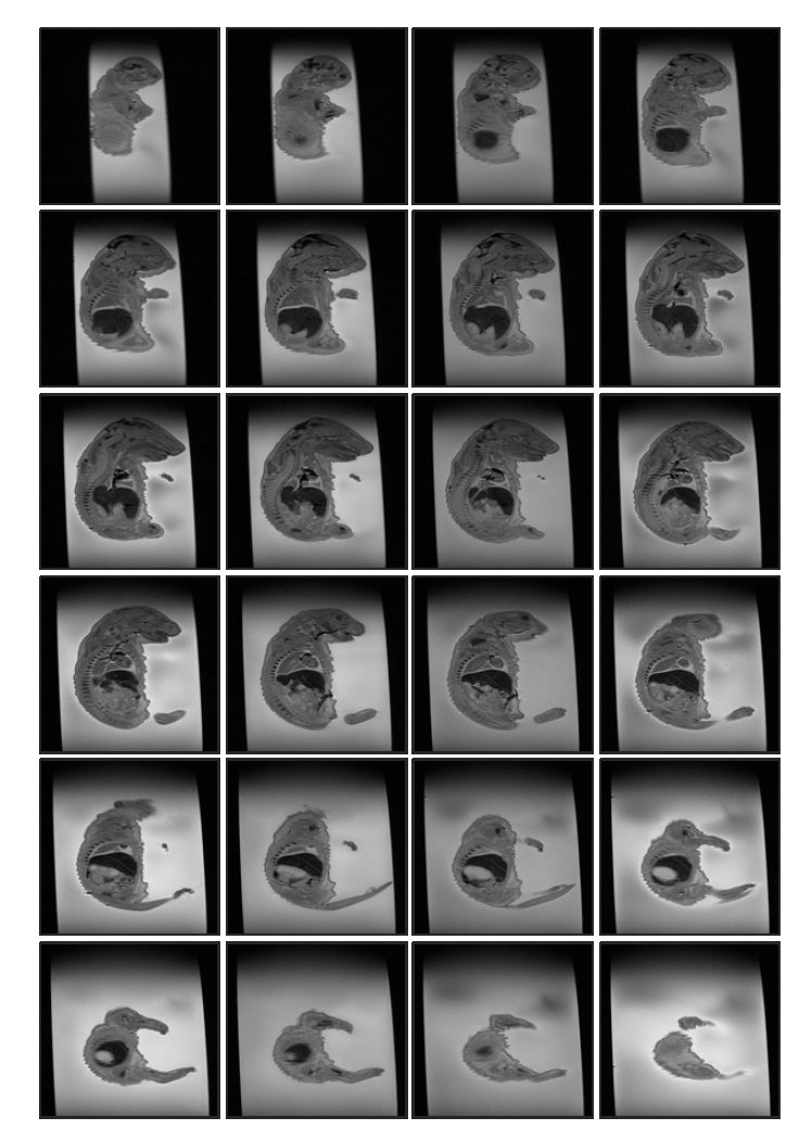 Cyclophosphamide 투여 (rat 4, ex-vivo) 후 태자의 20일 째 T2 weighted images