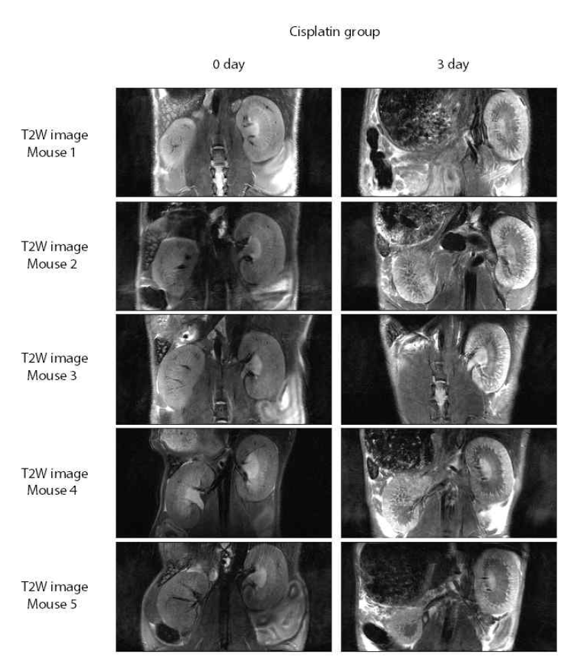 Cisplatin 투여 (rat 1~5) 후의 신장 T2 weighted images