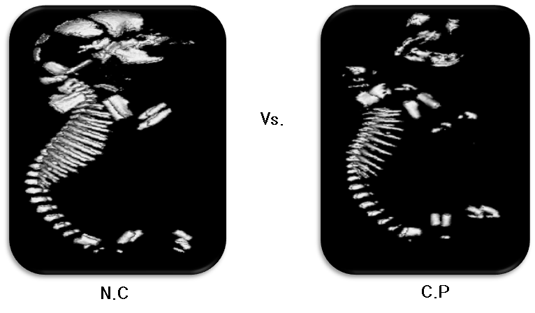 micro CT를 이용한 태자 골격 비교: C.P 투여군의 태자의 골형성이 늦는 것을 볼 수있으며 특히 두개골의 형성이 늦는 것을 확인할 수 있었음.